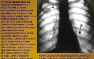 Принципиальные отличия рентгена от флюорографии Цифровая рентгенография легких